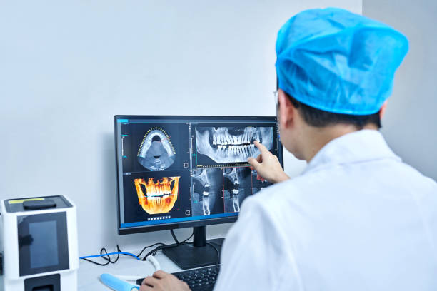 Best Emergency Root Canal Therapy in Abingdon, MD
